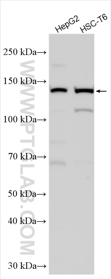 Western Blot (WB) analysis of various lysates using ULK1 Polyclonal antibody (27352-1-AP)
