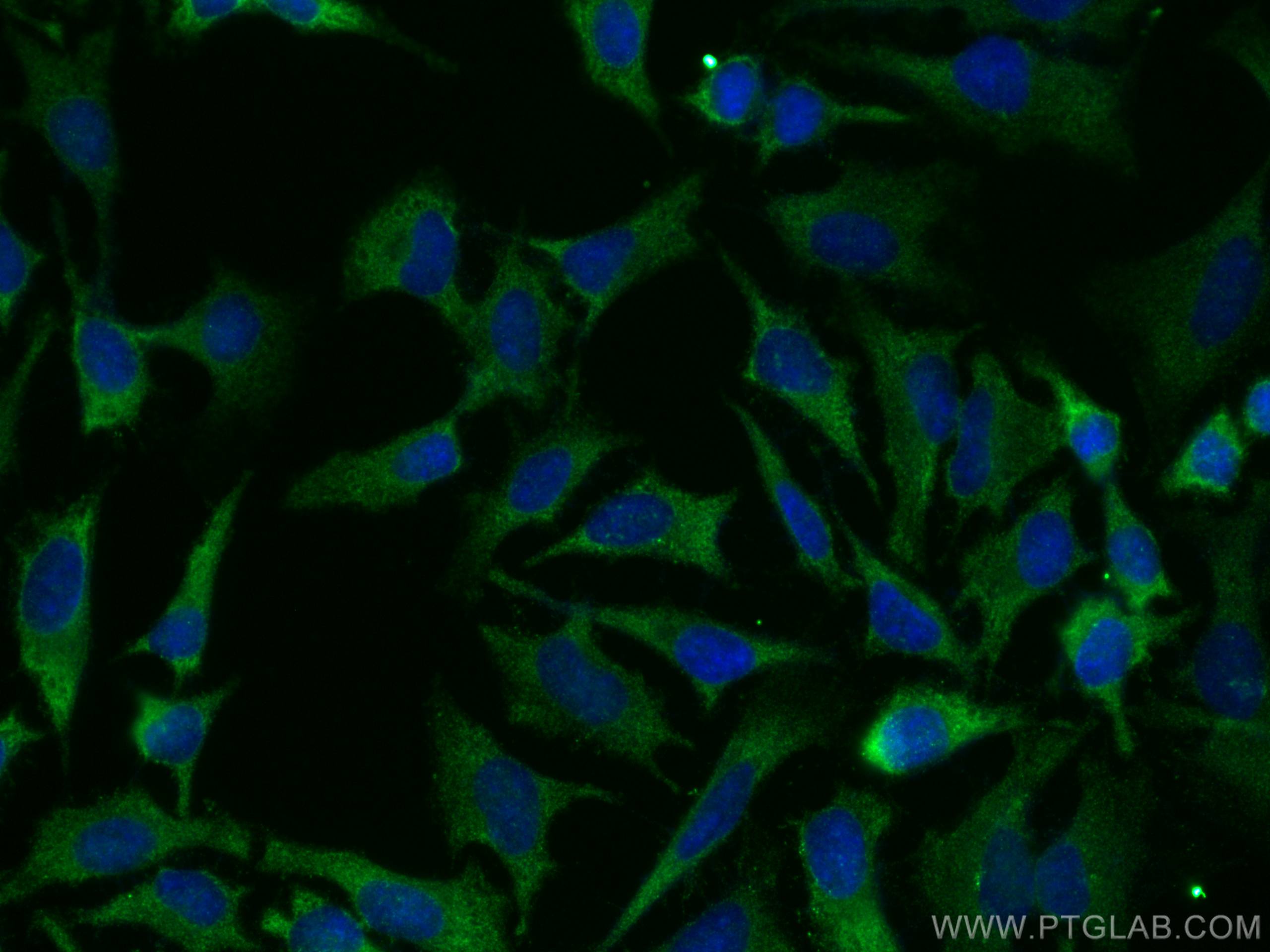Immunofluorescence (IF) / fluorescent staining of HeLa cells using ULK1 Polyclonal antibody (29005-1-AP)