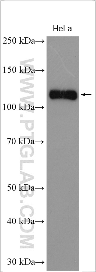 Western Blot (WB) analysis of HeLa cells using ULK1 Polyclonal antibody (29005-1-AP)