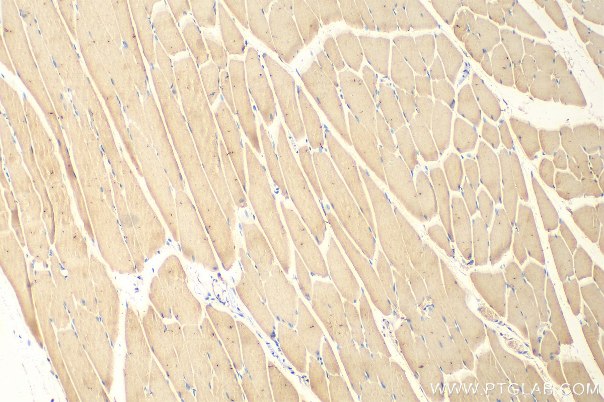 Immunohistochemistry (IHC) staining of mouse skeletal muscle tissue using ULK1 Monoclonal antibody (68445-1-Ig)