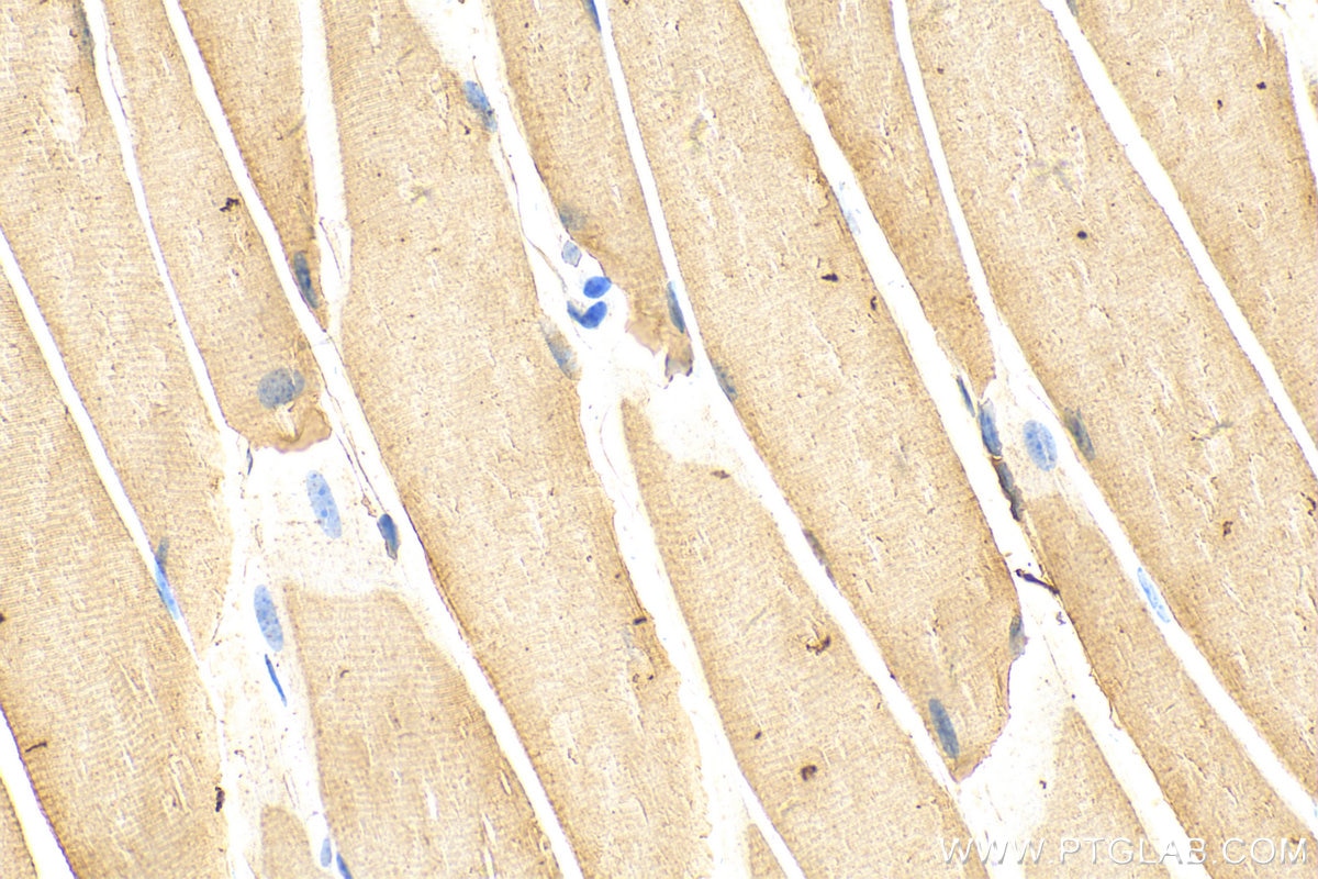 Immunohistochemistry (IHC) staining of mouse skeletal muscle tissue using ULK1 Monoclonal antibody (68445-1-Ig)