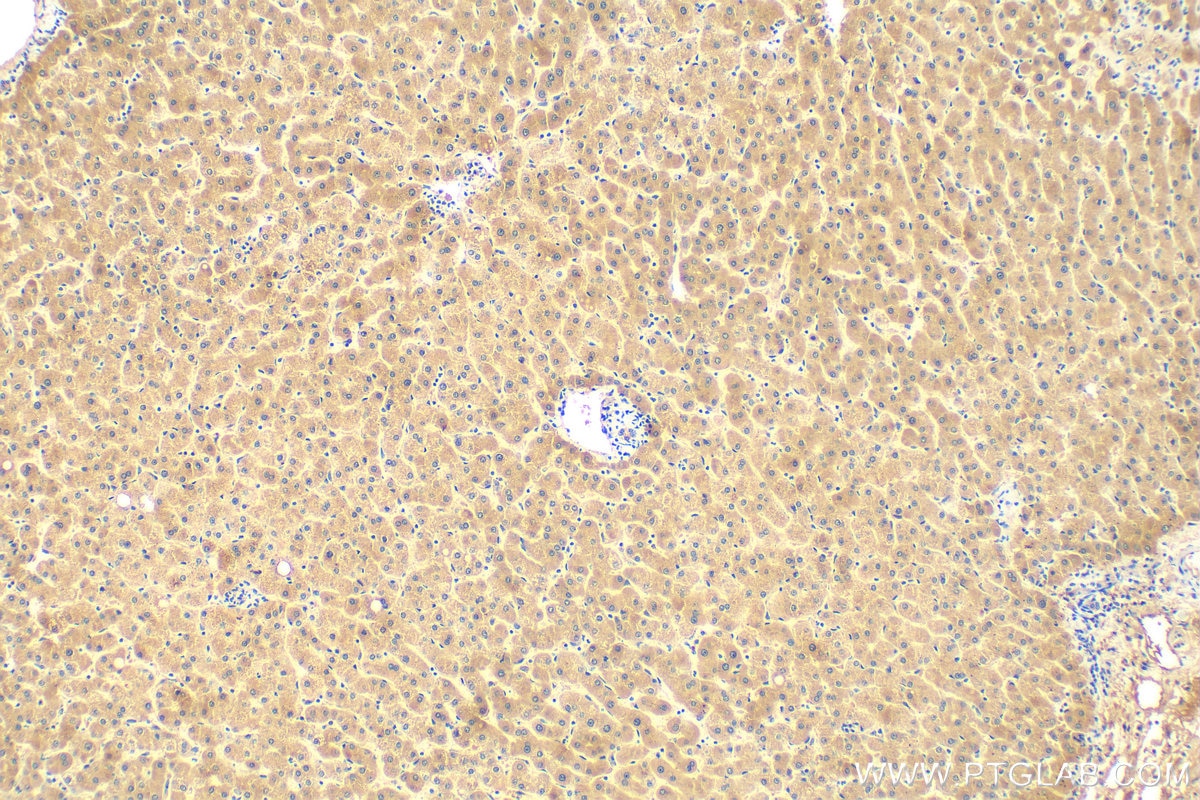 Immunohistochemistry (IHC) staining of human liver tissue using ULK1 Monoclonal antibody (68445-1-Ig)