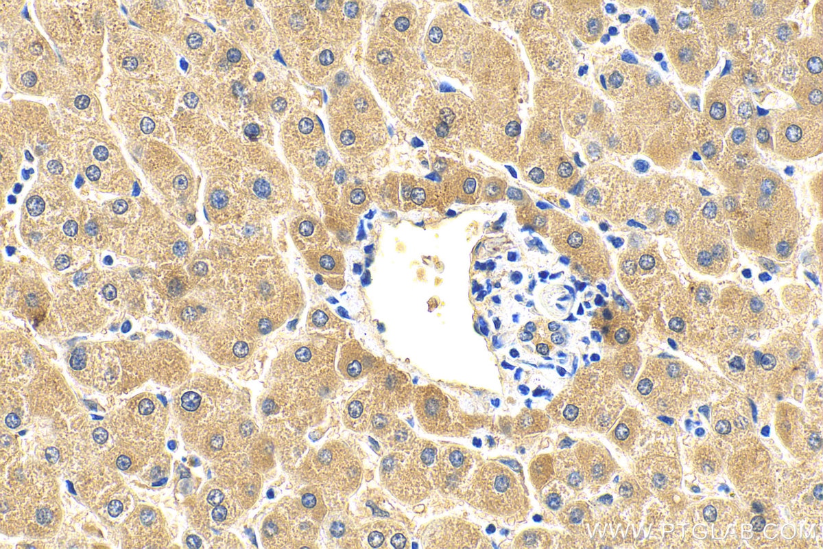 Immunohistochemistry (IHC) staining of human liver tissue using ULK1 Monoclonal antibody (68445-1-Ig)