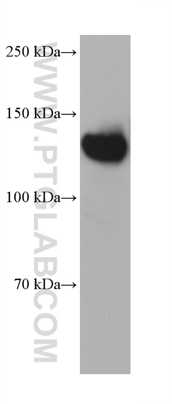Western Blot (WB) analysis of PC-3 cells using ULK1 Monoclonal antibody (68445-1-Ig)