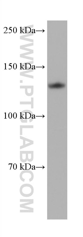 Western Blot (WB) analysis of HeLa cells using ULK1 Monoclonal antibody (68445-1-Ig)