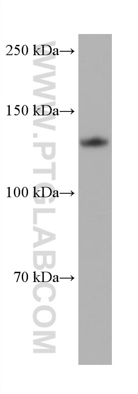 WB analysis of HeLa using 68445-1-Ig