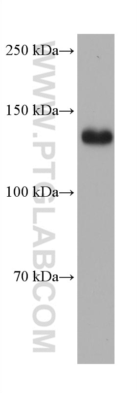 Western Blot (WB) analysis of Jurkat cells using ULK1 Monoclonal antibody (68445-1-Ig)