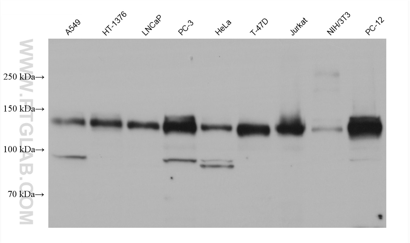 Western Blot (WB) analysis of various lysates using ULK1 Monoclonal antibody (68445-1-Ig)