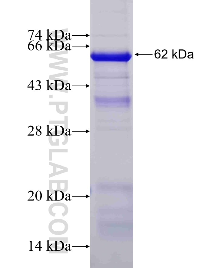 ULK1 fusion protein Ag22397 SDS-PAGE
