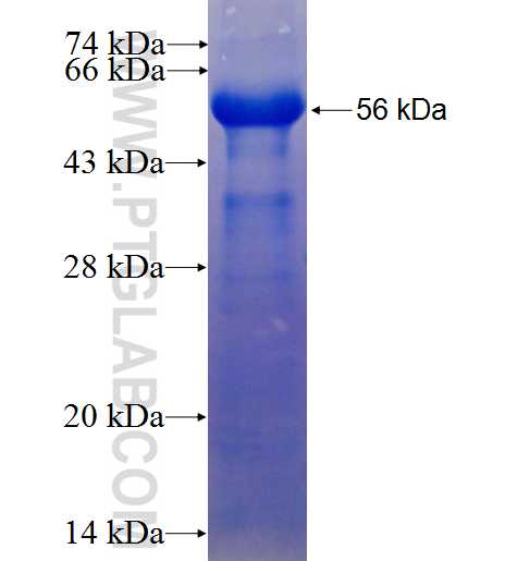 ULK1 fusion protein Ag17776 SDS-PAGE