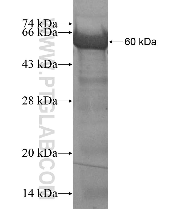 ULK1 fusion protein Ag17795 SDS-PAGE