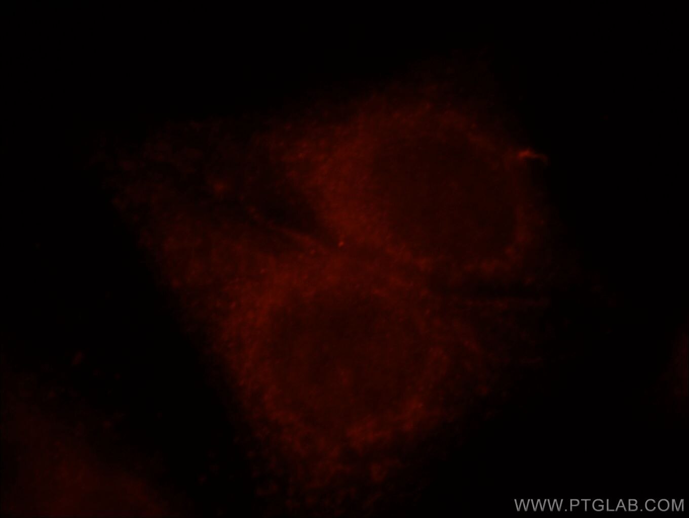 Uromodulin