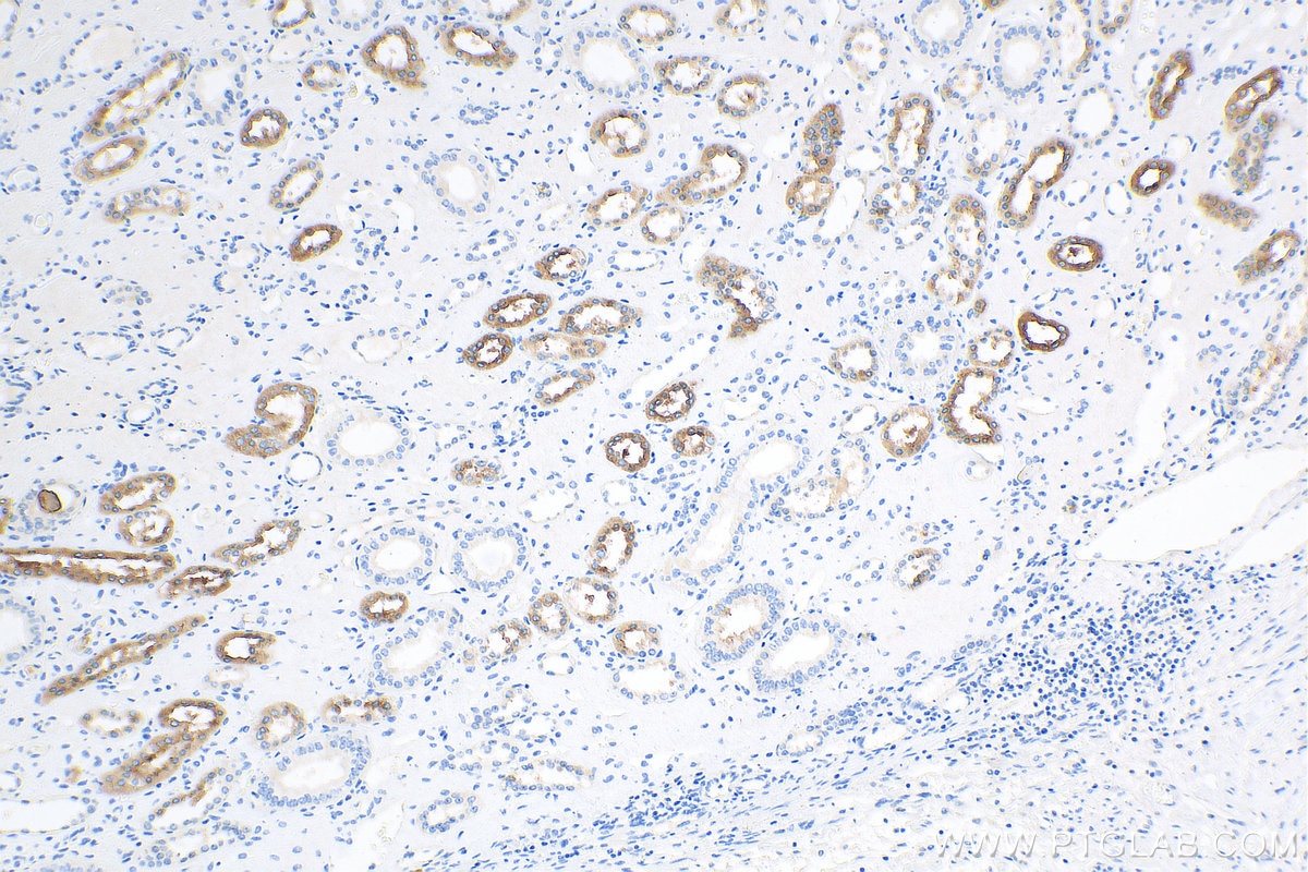 Immunohistochemistry (IHC) staining of human kidney tissue using Uromodulin Polyclonal antibody (11911-1-AP)