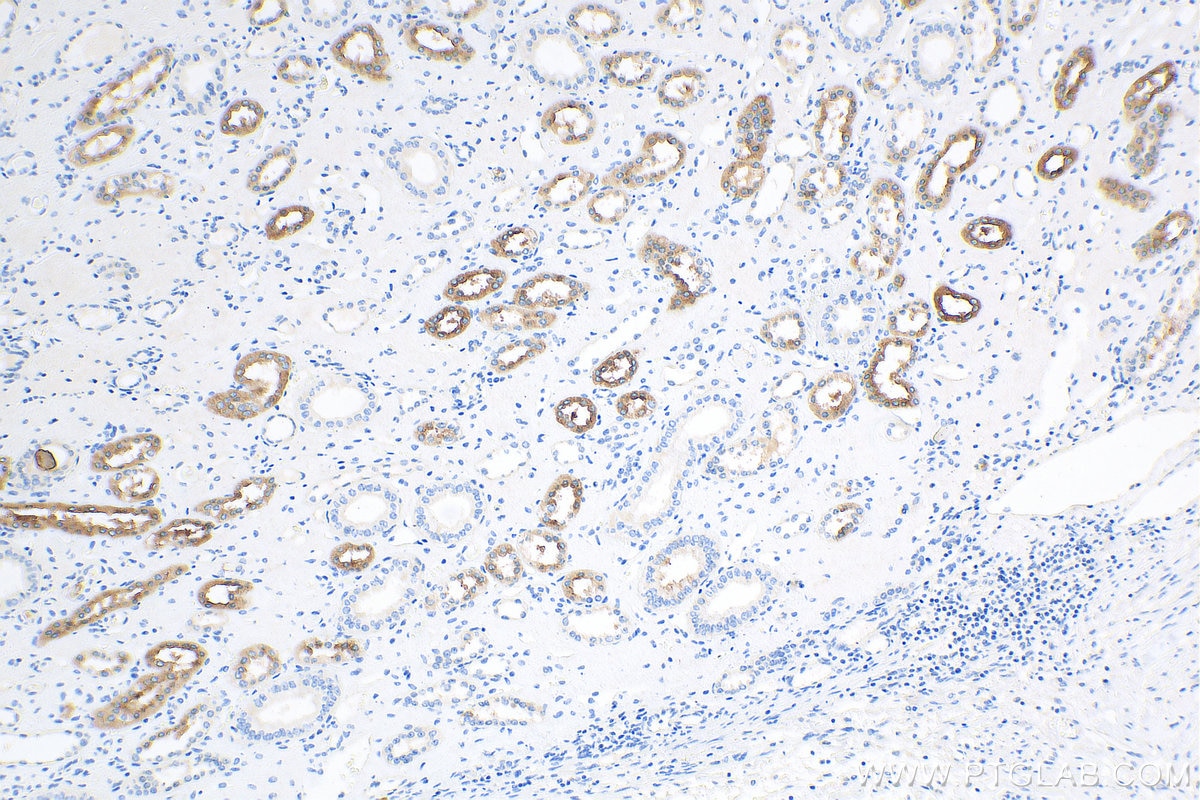 IHC staining of human kidney using 11911-1-AP