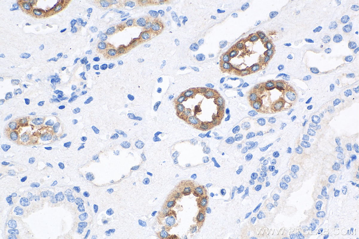 Immunohistochemistry (IHC) staining of human kidney tissue using Uromodulin Polyclonal antibody (11911-1-AP)