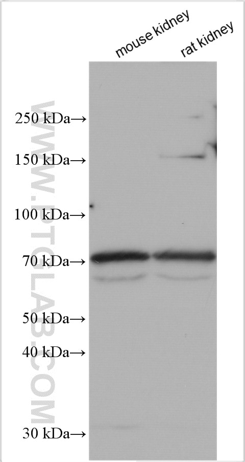 Western Blot (WB) analysis of various lysates using Uromodulin Polyclonal antibody (11911-1-AP)