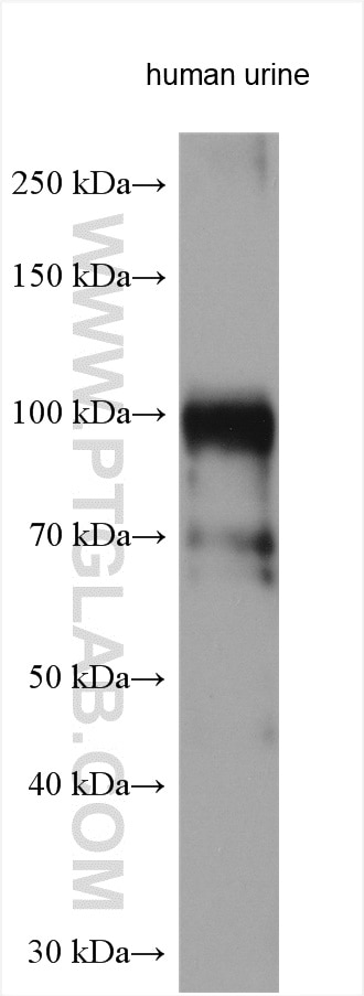 Western Blot (WB) analysis of human urine sample using Uromodulin Polyclonal antibody (11911-1-AP)