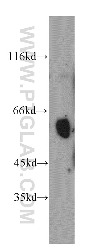 Uromodulin Polyclonal antibody