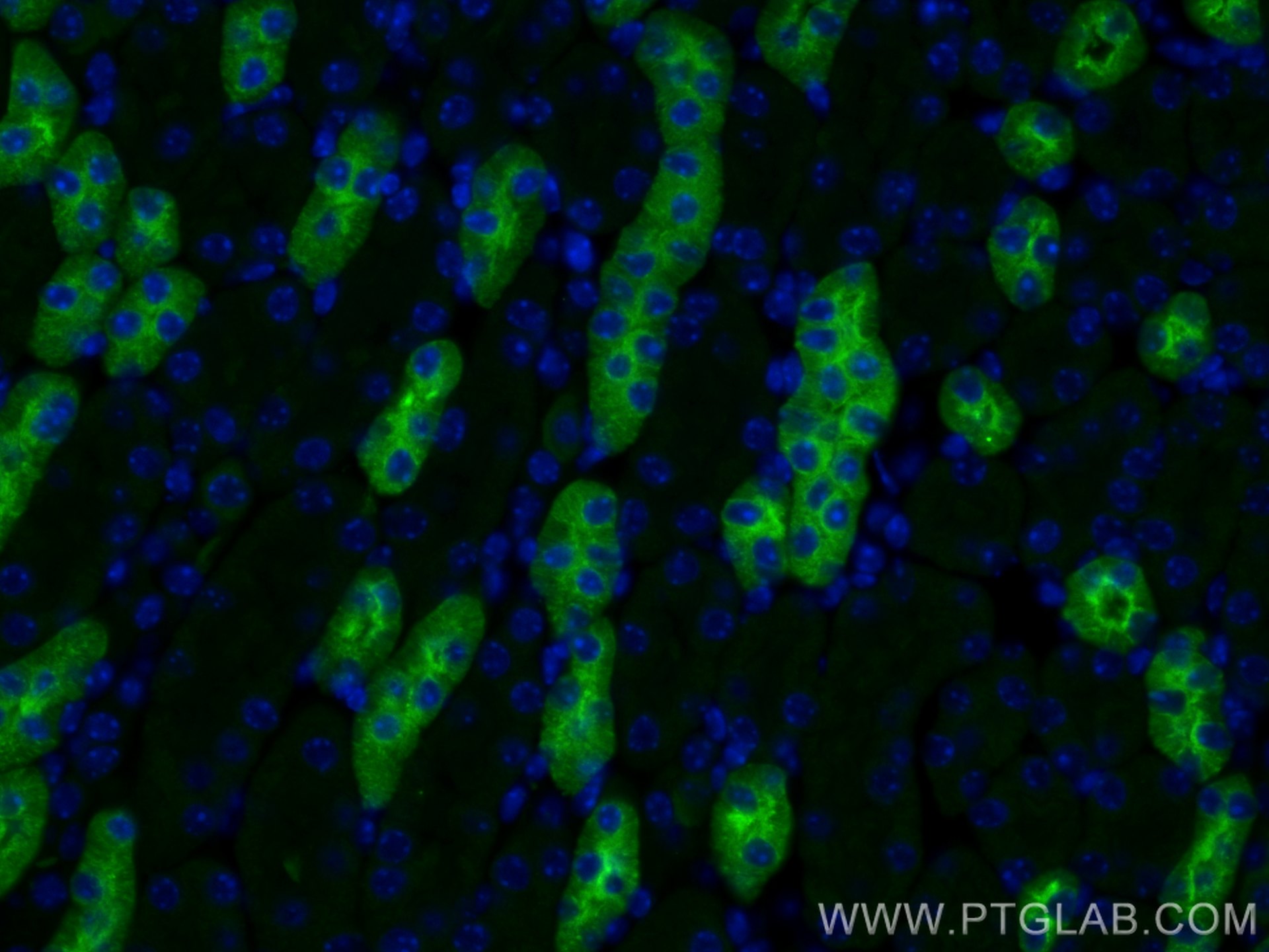 Immunofluorescence (IF) / fluorescent staining of mouse kidney tissue using Uromodulin Polyclonal antibody (29975-1-AP)