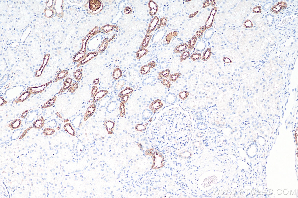Immunohistochemistry (IHC) staining of human kidney tissue using Uromodulin Polyclonal antibody (29975-1-AP)