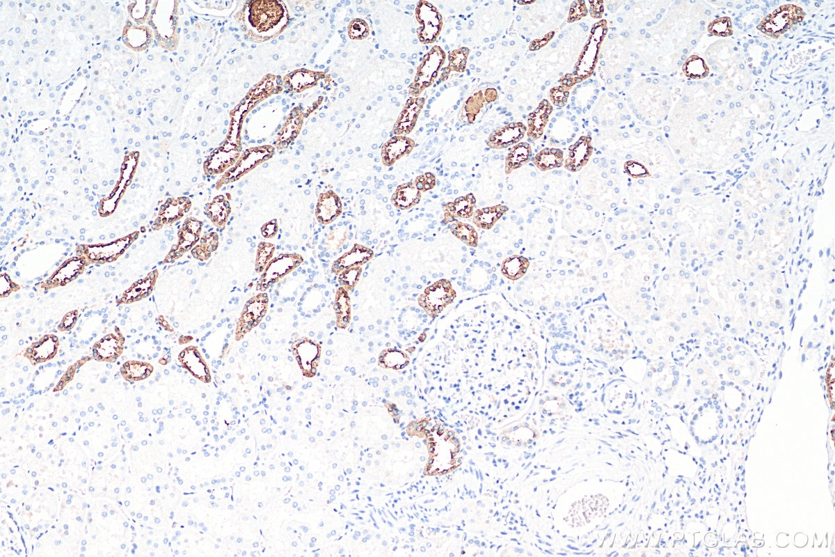 IHC staining of human kidney using 29975-1-AP