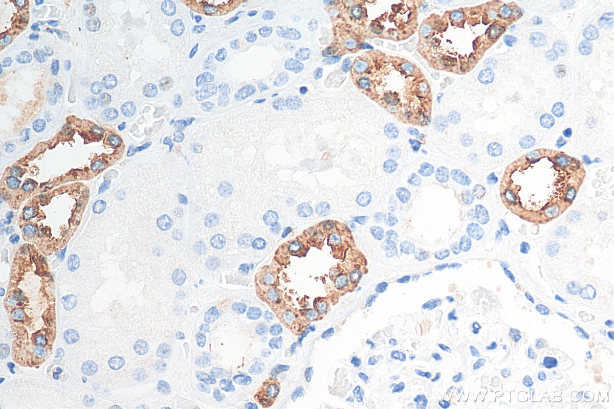 Immunohistochemistry (IHC) staining of human kidney tissue using Uromodulin Polyclonal antibody (29975-1-AP)