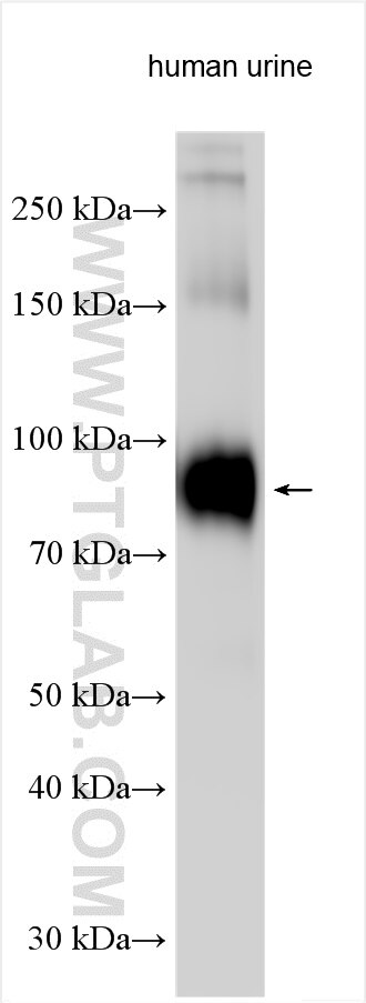 Western Blot (WB) analysis of human urine sample using Uromodulin Polyclonal antibody (29975-1-AP)