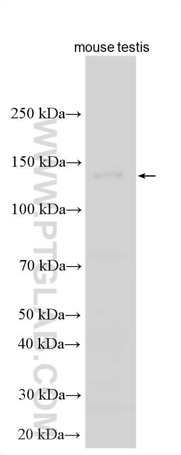 WB analysis using 31666-1-AP (same clone as 31666-1-PBS) Western Blot (WB) analysis of various lysates using UMODL1 Polyclonal antibody (31666-1-AP)