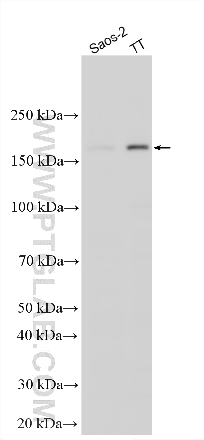 WB analysis using 31666-1-AP (same clone as 31666-1-PBS) Western Blot (WB) analysis of various lysates using UMODL1 Polyclonal antibody (31666-1-AP)