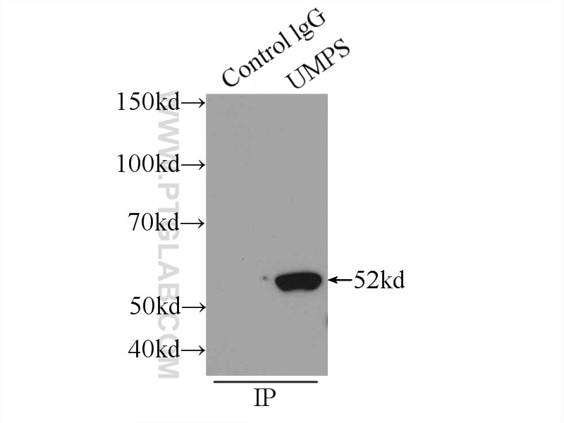 IP experiment of HEK-293 using 14830-1-AP