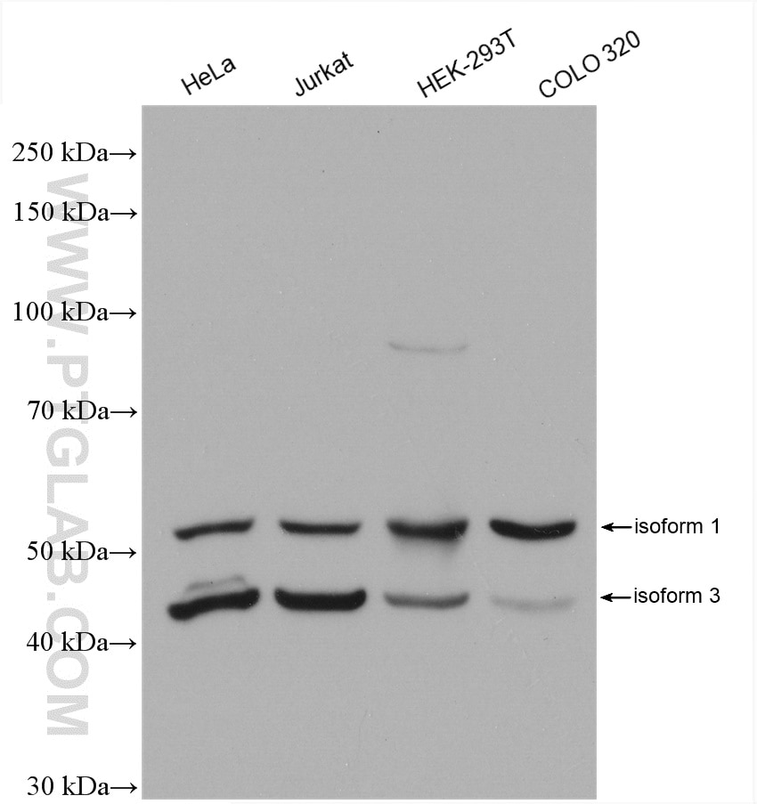 Western Blot (WB) analysis of various lysates using UMPS Polyclonal antibody (14830-1-AP)