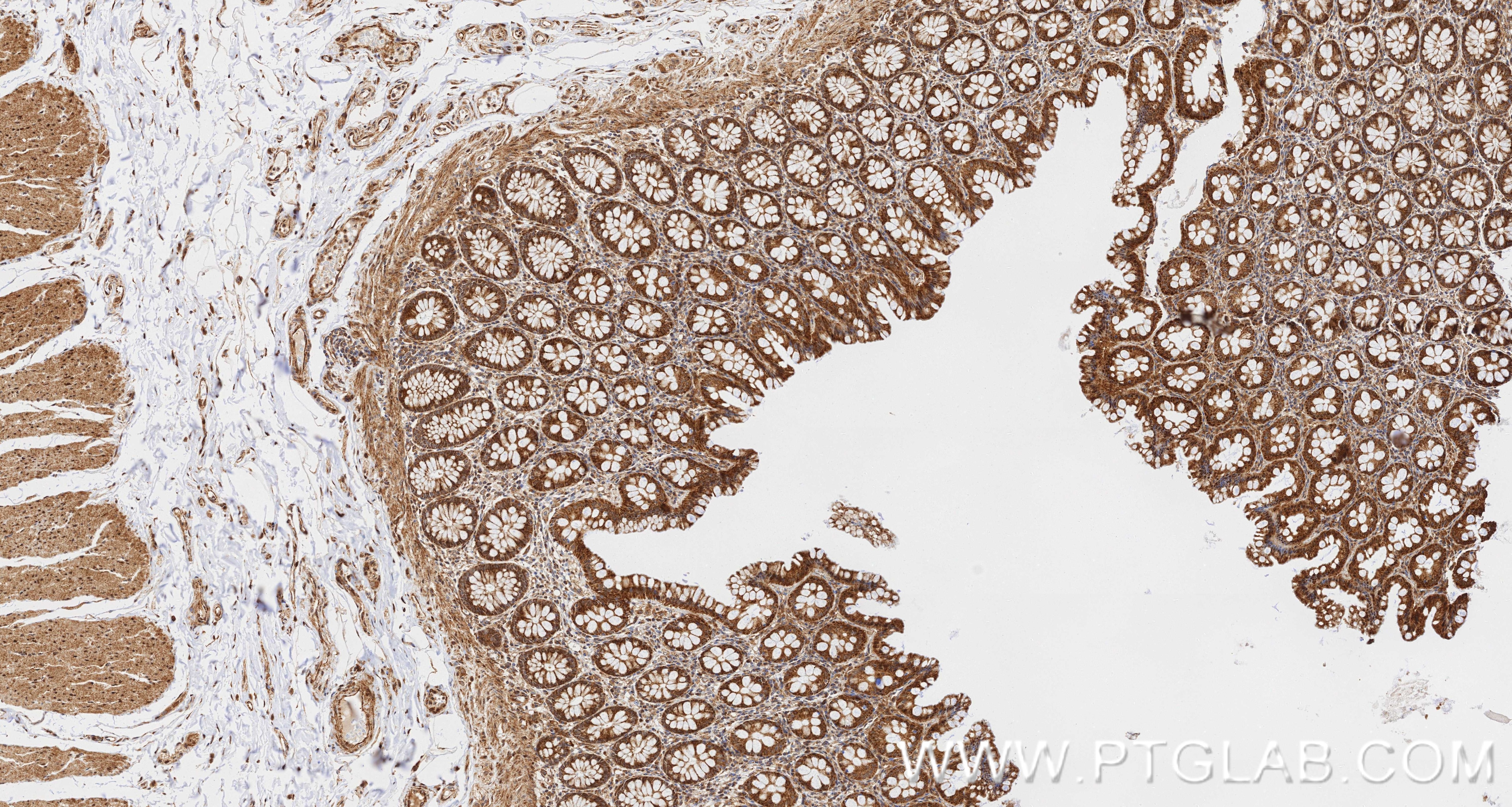 Immunohistochemistry (IHC) staining of human colon tissue using UMPS Recombinant monoclonal antibody (86260-4-RR)