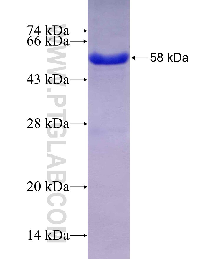 UMPS fusion protein Ag6620 SDS-PAGE