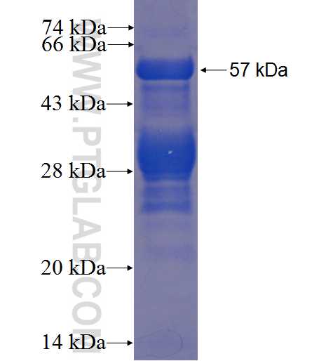 UNC119 fusion protein Ag3757 SDS-PAGE