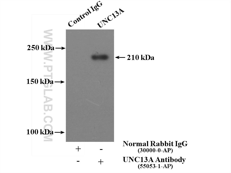 Immunoprecipitation (IP) experiment of mouse brain tissue using UNC13A/Munc13-1 Polyclonal antibody (55053-1-AP)