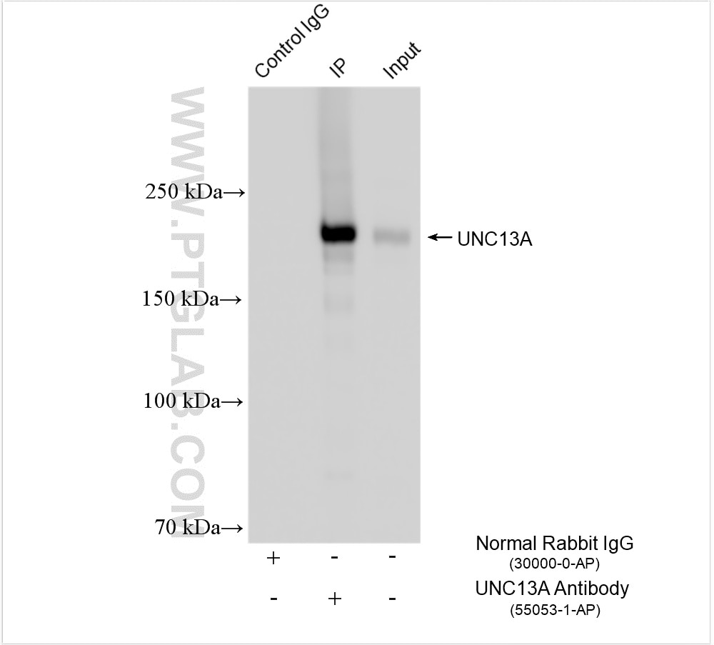 Immunoprecipitation (IP) experiment of mouse brain tissue using UNC13A Polyclonal antibody (55053-1-AP)