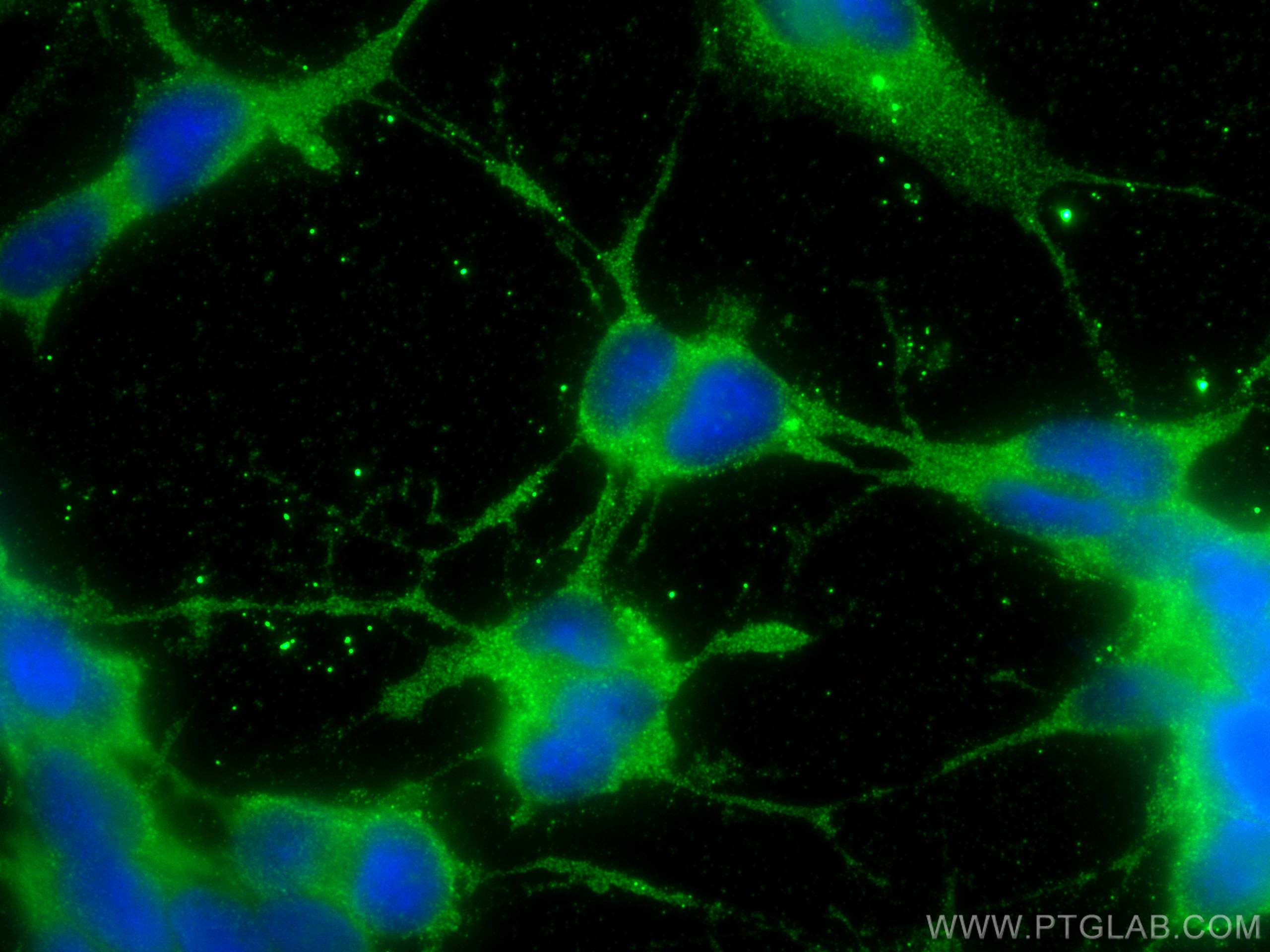 Immunofluorescence (IF) / fluorescent staining of SH-SY5Y cells using UNC13A Monoclonal antibody (68483-1-Ig)