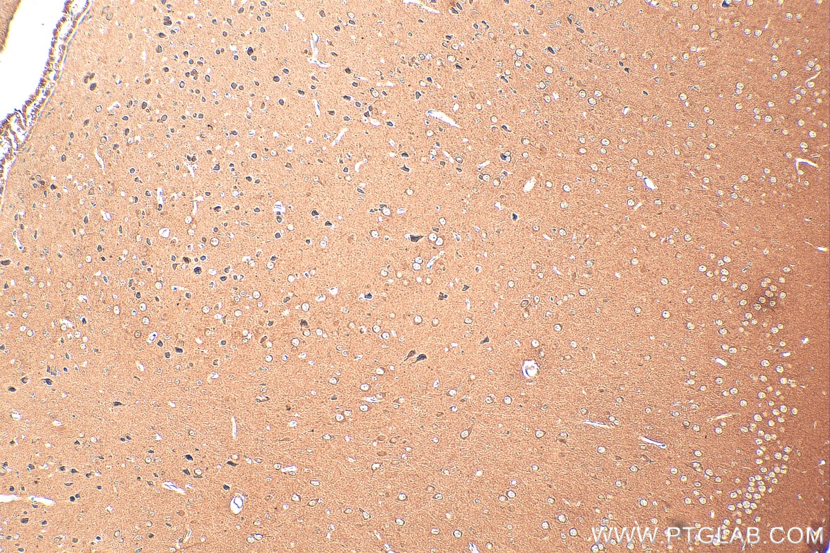 Immunohistochemistry (IHC) staining of mouse brain tissue using UNC13A Monoclonal antibody (68483-1-Ig)