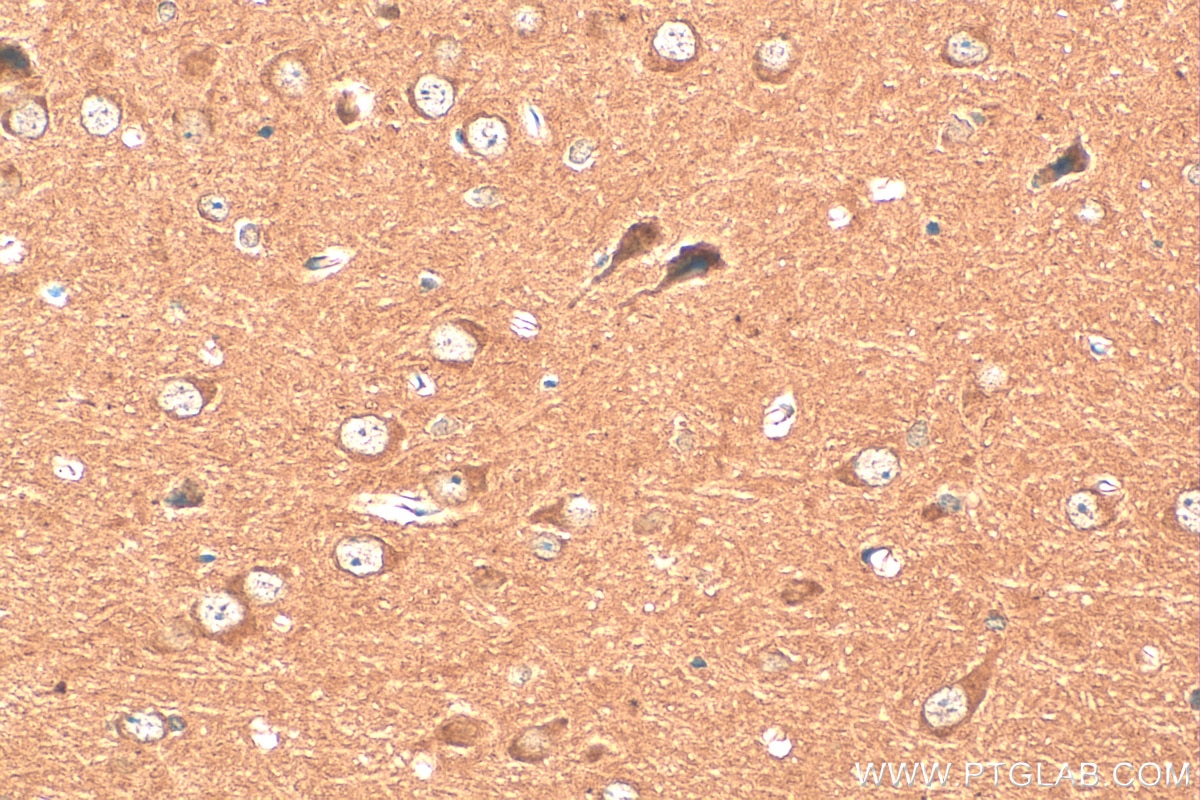 Immunohistochemistry (IHC) staining of mouse brain tissue using UNC13A Monoclonal antibody (68483-1-Ig)