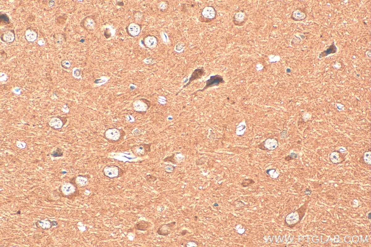 Immunohistochemistry (IHC) staining of mouse brain tissue using UNC13A Monoclonal antibody (68483-1-Ig)