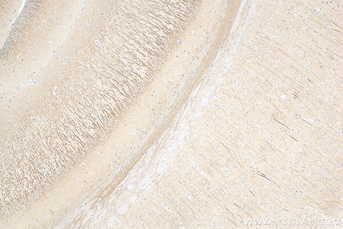 Immunohistochemistry (IHC) staining of mouse brain tissue using UNC13A Recombinant antibody (83000-5-RR)