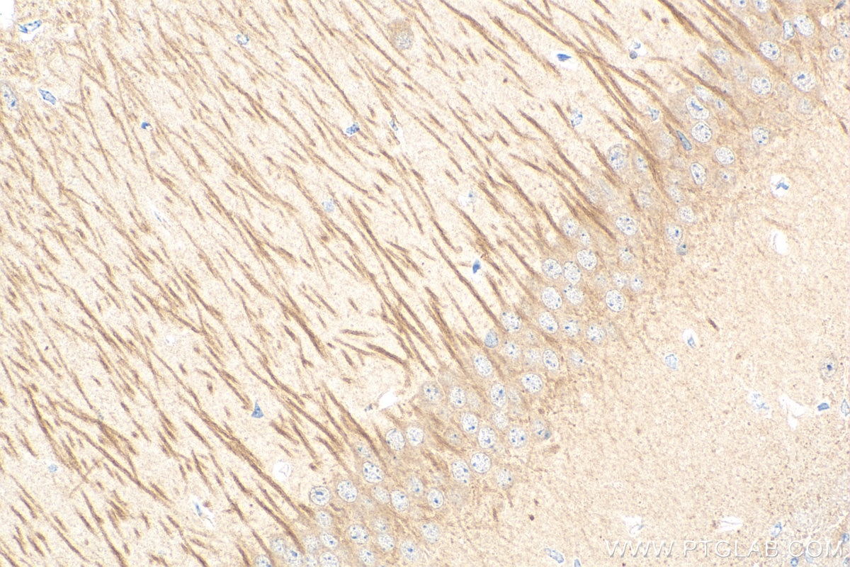 Immunohistochemistry (IHC) staining of mouse brain tissue using UNC13A Recombinant antibody (83000-5-RR)