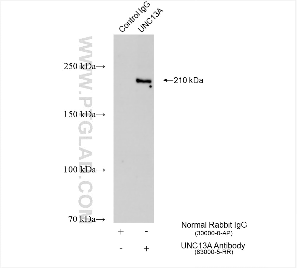 Immunoprecipitation (IP) experiment of mouse brain tissue using UNC13A Recombinant antibody (83000-5-RR)