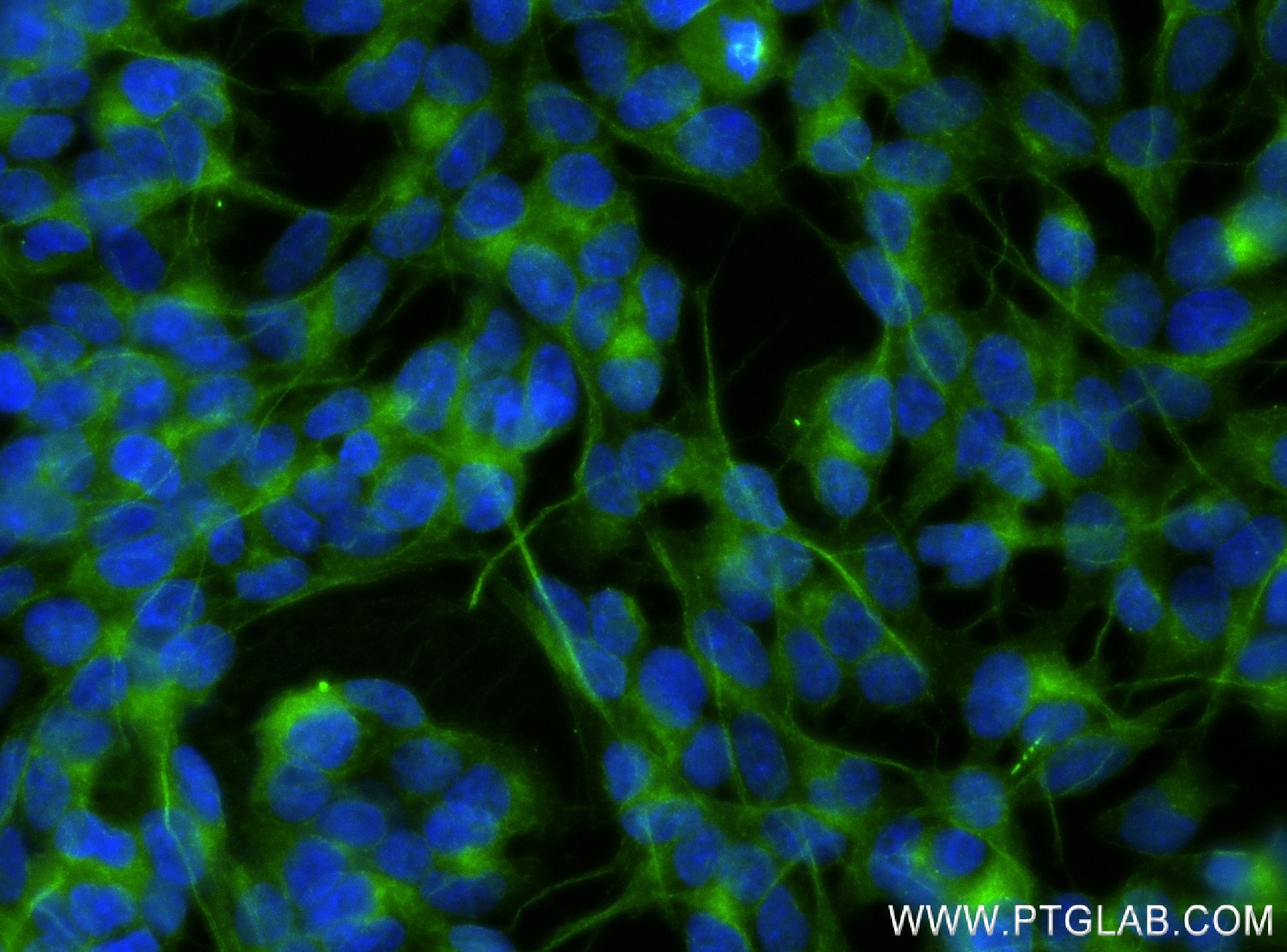 Immunofluorescence (IF) / fluorescent staining of SH-SY5Y cells using UNC13A Recombinant antibody (83000-6-RR)