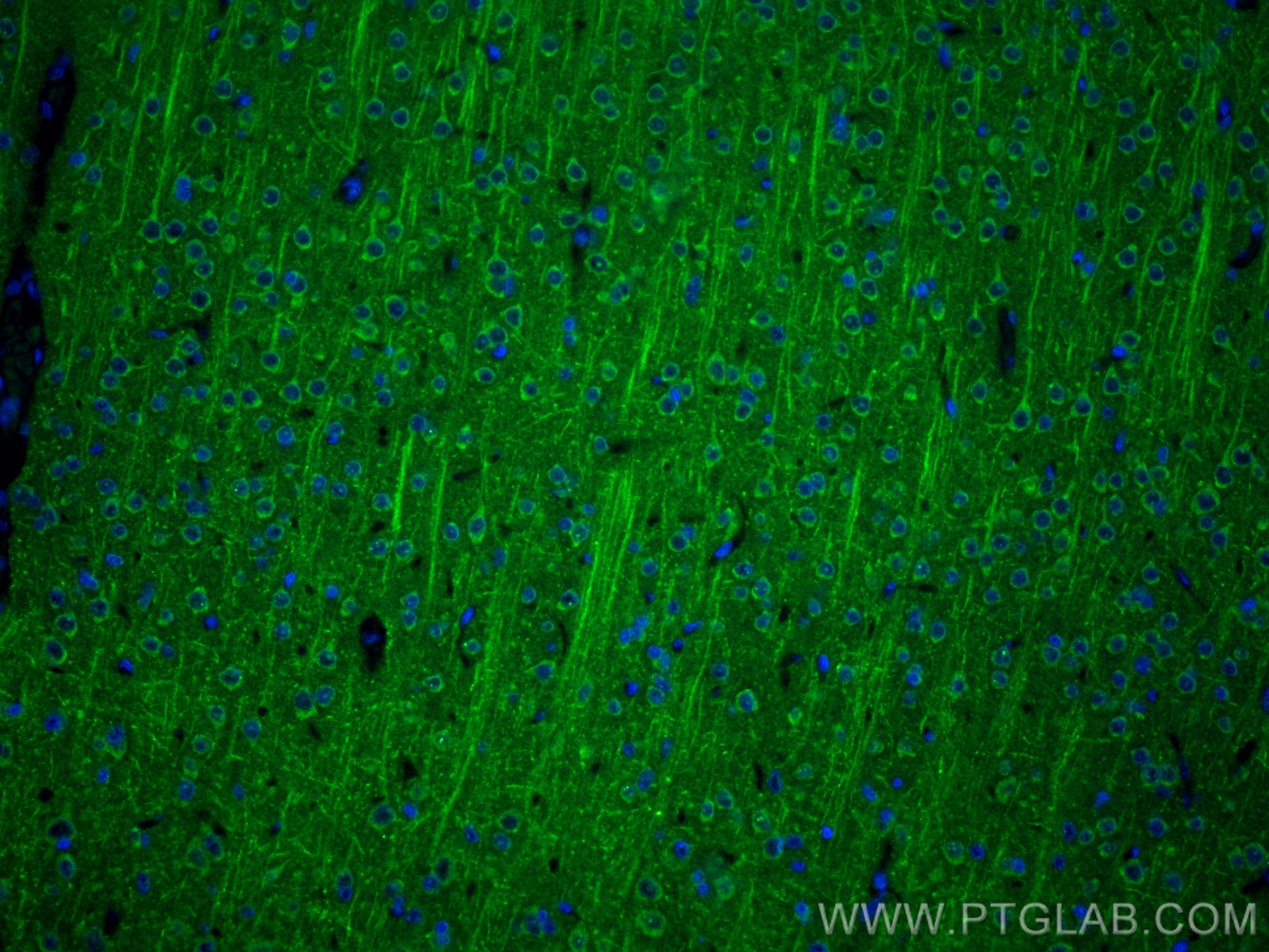 Immunofluorescence (IF) / fluorescent staining of rat brain tissue using UNC13A Recombinant antibody (83000-6-RR)