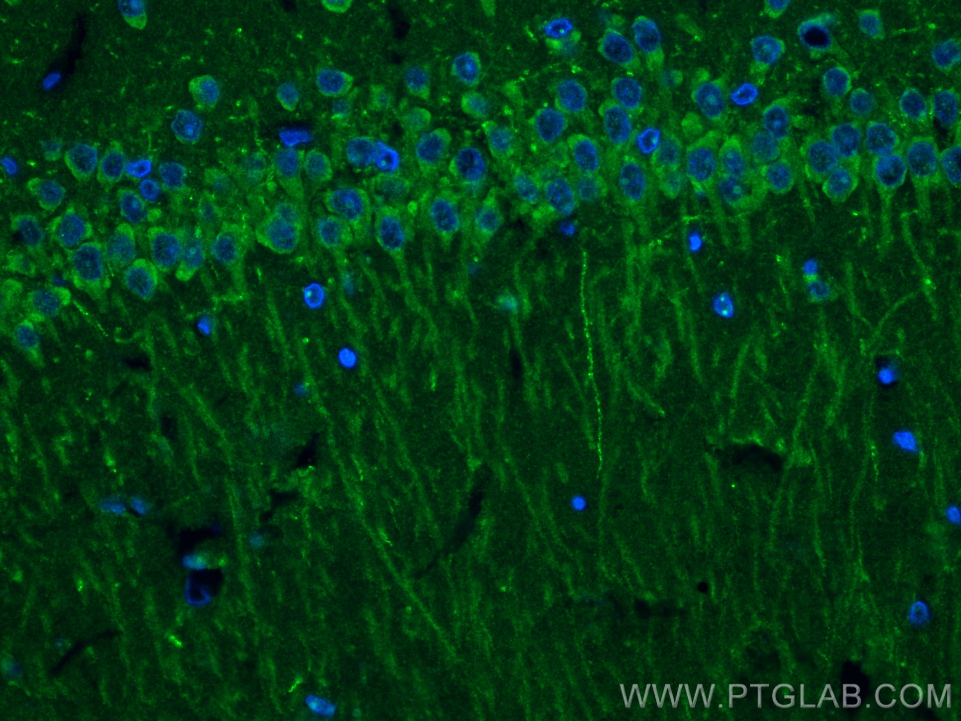 Immunofluorescence (IF) / fluorescent staining of rat brain tissue using UNC13A Recombinant antibody (83000-6-RR)