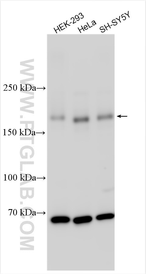 Western Blot (WB) analysis of various lysates using UNC13B Polyclonal antibody (21839-1-AP)