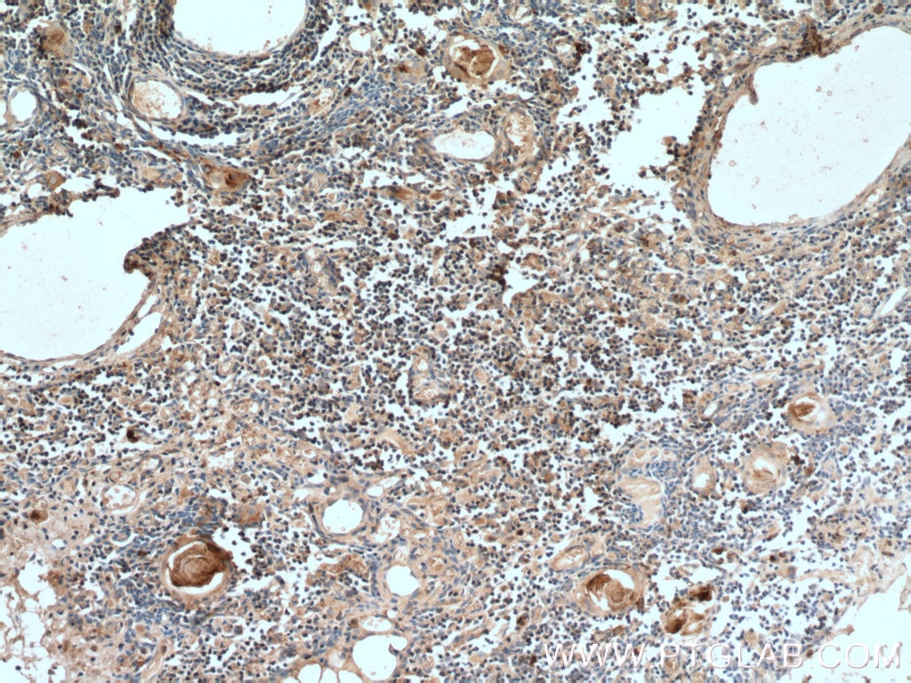 Immunohistochemistry (IHC) staining of human thymus tissue using UNC13D/Munc13-4 Polyclonal antibody (16905-1-AP)