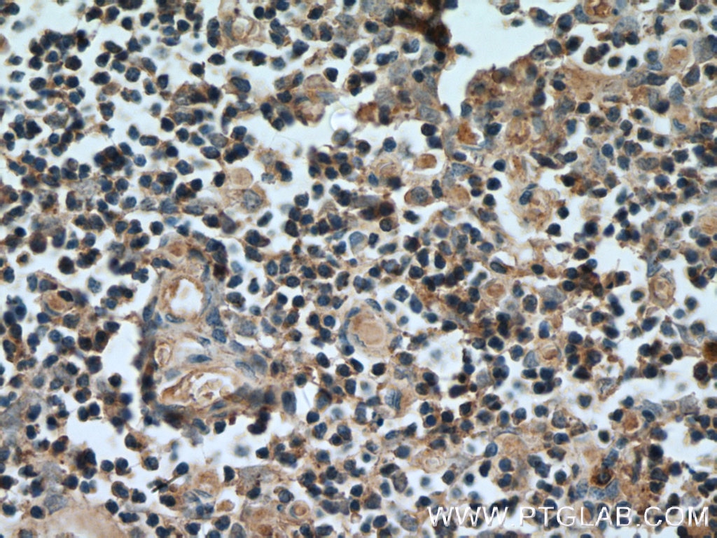 Immunohistochemistry (IHC) staining of human thymus tissue using UNC13D/Munc13-4 Polyclonal antibody (16905-1-AP)