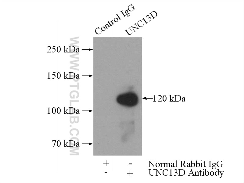 Immunoprecipitation (IP) experiment of Jurkat cells using UNC13D/Munc13-4 Polyclonal antibody (16905-1-AP)
